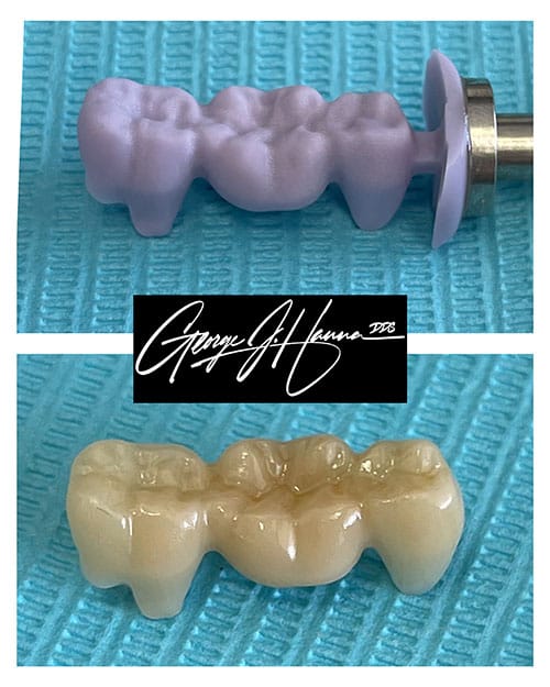 in-house milled bridge